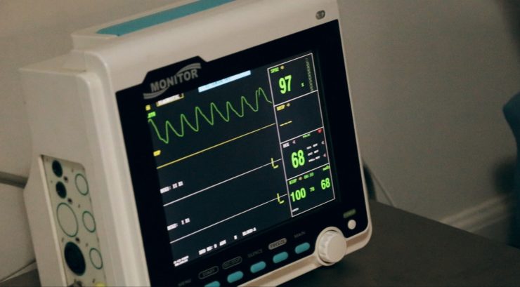 photo of a heart monitor display